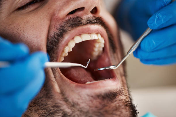 Best Dentist for Tooth Abscess  in Church Point, LA